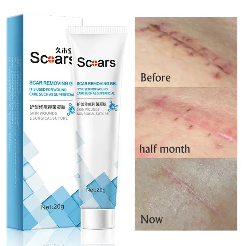 3 pc Skin Repair Scar Removal Gel Cream - 20gm