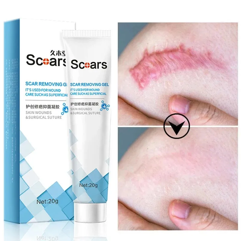 3 pc Skin Repair Scar Removal Gel Cream - 20gm