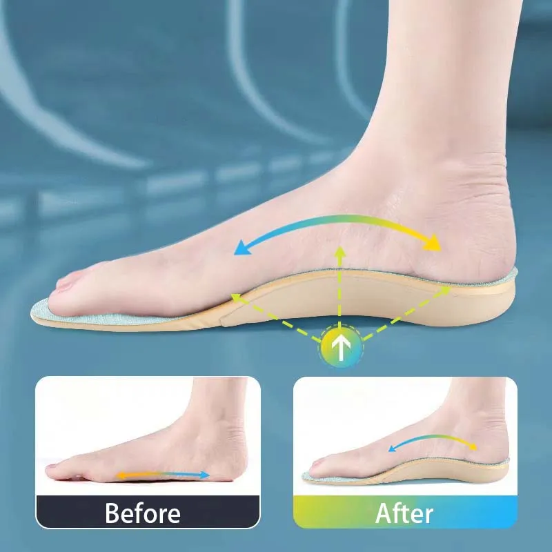 Dbeck® Shock Absorbing Orthotic Insoles for Flat Feet and Arch Support